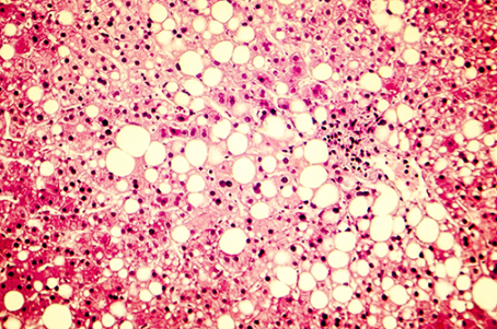Gene Guided Nutri Big Image