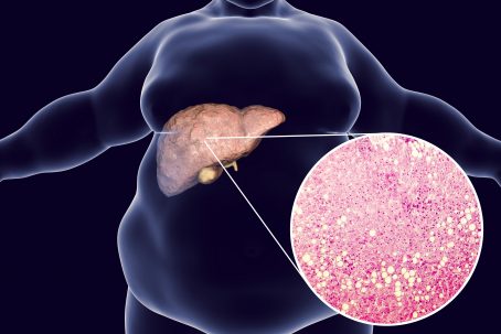 Gene Guided Nutri Big Image